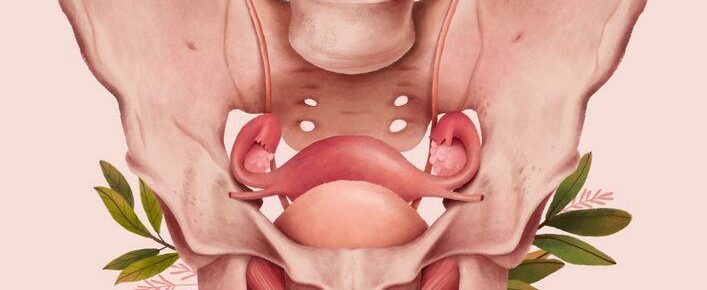 A personal take on endometriosis